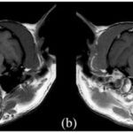 Cat’s Otitis Media and Interna