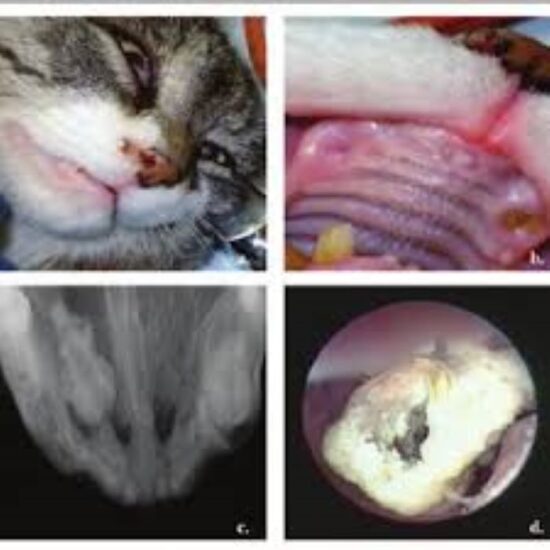 Nasal Foreign Bodies